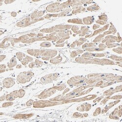 Invitrogen Tara Polyclonal Antibody 100 &mu;L; Unconjugated:Antibodies,