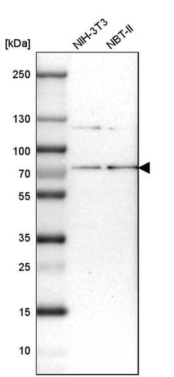 Invitrogen HCE Polyclonal Antibody 100 &mu;L | Buy Online | Invitrogen&trade; | Fisher Scientific