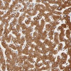 Invitrogen MAGEB17 Polyclonal Antibody 100 &mu;L; Unconjugated:Antibodies,