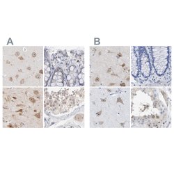Invitrogen PNMA1 Polyclonal Antibody 100 &mu;L; Unconjugated:Antibodies,