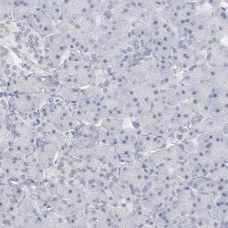 Invitrogen PNMA1 Polyclonal Antibody 100 &mu;L; Unconjugated:Antibodies,