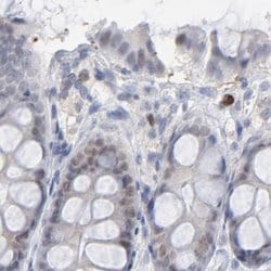 Invitrogen PNMA1 Polyclonal Antibody 100 &mu;L; Unconjugated:Antibodies,