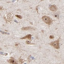 Invitrogen PNMA1 Polyclonal Antibody 100 &mu;L; Unconjugated:Antibodies,