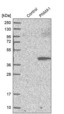 Invitrogen PNMA1 Polyclonal Antibody 100 &mu;L; Unconjugated:Antibodies,