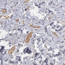 Invitrogen Factor XIII B Polyclonal Antibody 100 &mu;L; Unconjugated:Antibodies,