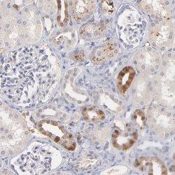 Invitrogen Factor XIII B Polyclonal Antibody 100 &mu;L; Unconjugated:Antibodies,