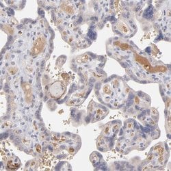 Invitrogen Factor XIII B Polyclonal Antibody 100 &mu;L; Unconjugated:Antibodies,