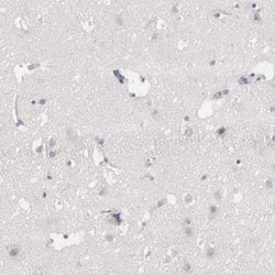 Invitrogen Factor XIII B Polyclonal Antibody 100 &mu;L; Unconjugated:Antibodies,