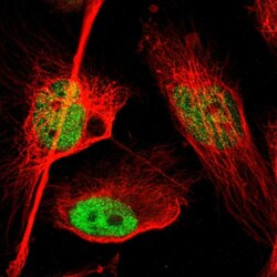 Invitrogen FOXP1 Polyclonal Antibody 100 &mu;L; Unconjugated:Antibodies,