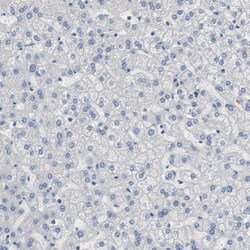 Invitrogen FOXP1 Polyclonal Antibody 100 &mu;L; Unconjugated:Antibodies,