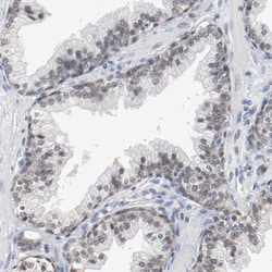 Invitrogen FOXP1 Polyclonal Antibody 100 &mu;L; Unconjugated:Antibodies,