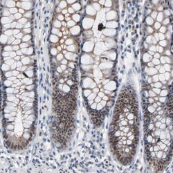 Invitrogen FOXP1 Polyclonal Antibody 100 &mu;L; Unconjugated:Antibodies,