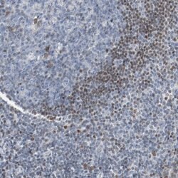 Invitrogen FOXP1 Polyclonal Antibody 100 &mu;L; Unconjugated:Antibodies,