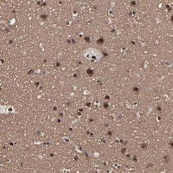 Invitrogen PDZD4 Polyclonal Antibody 100 &mu;L; Unconjugated:Antibodies,