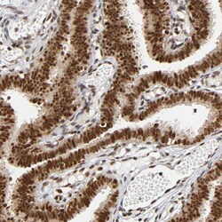 Invitrogen RNF122 Polyclonal Antibody 100 &mu;L; Unconjugated:Antibodies,