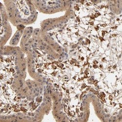 Invitrogen VSIG4 Polyclonal Antibody 100 &mu;L; Unconjugated:Antibodies,