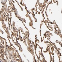 Invitrogen VSIG4 Polyclonal Antibody 100 &mu;L; Unconjugated:Antibodies,