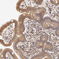 Invitrogen CHST7 Polyclonal Antibody 100 &mu;L; Unconjugated:Antibodies,