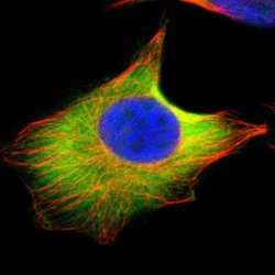 Invitrogen UBE2D4 Polyclonal Antibody 100 &mu;L; Unconjugated:Antibodies,