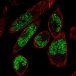 Invitrogen MAMLD1 Polyclonal Antibody 100 &mu;L; Unconjugated:Antibodies,