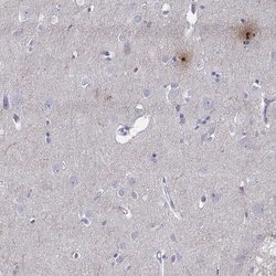 Invitrogen PCSK1N Polyclonal Antibody 100 &mu;L; Unconjugated:Antibodies,
