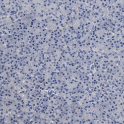Invitrogen CCDC134 Polyclonal Antibody 100 &mu;L | Buy Online | Invitrogen&trade; | Fisher Scientific