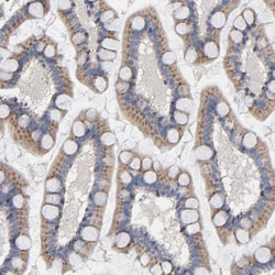 Invitrogen CCDC134 Polyclonal Antibody 100 &mu;L | Buy Online | Invitrogen&trade; | Fisher Scientific