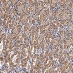 Invitrogen CCDC134 Polyclonal Antibody 100 &mu;L | Buy Online | Invitrogen&trade; | Fisher Scientific