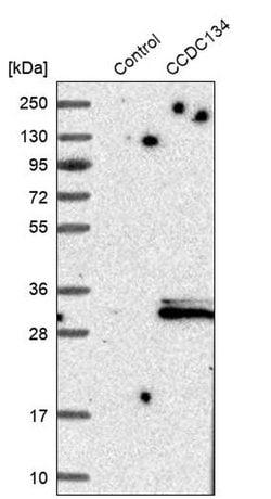 Invitrogen CCDC134 Polyclonal Antibody 100 &mu;L | Buy Online | Invitrogen&trade; | Fisher Scientific