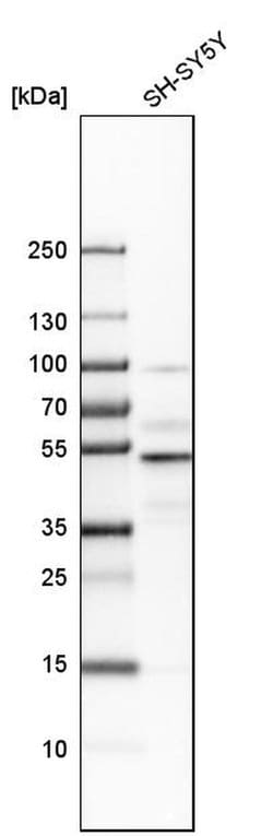 Invitrogen NFIB Polyclonal Antibody 100 &mu;L; Unconjugated:Antibodies,
