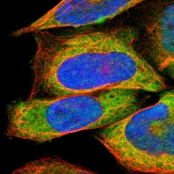 Invitrogen RARS Polyclonal Antibody 100 &mu;L; Unconjugated:Antibodies,