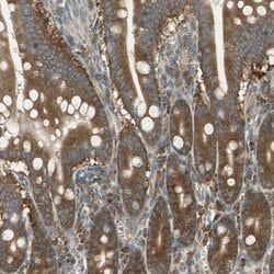 Invitrogen RARS Polyclonal Antibody 100 &mu;L; Unconjugated:Antibodies,