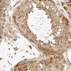 Invitrogen SGSM1 Polyclonal Antibody 100 &mu;L; Unconjugated:Antibodies,