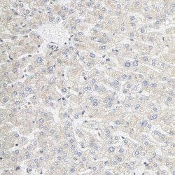 Invitrogen SGSM1 Polyclonal Antibody 100 &mu;L; Unconjugated:Antibodies,