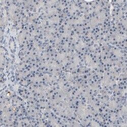 Invitrogen MT3 Polyclonal Antibody 100 μL; Unconjugated:Antibodies,