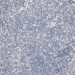 Invitrogen MT3 Polyclonal Antibody 100 μL; Unconjugated:Antibodies,