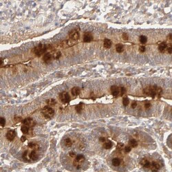 Invitrogen AP1G2 Polyclonal Antibody 100 &mu;L; Unconjugated:Antibodies,