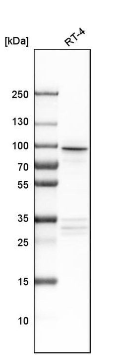 Invitrogen AP1G2 Polyclonal Antibody 100 &mu;L; Unconjugated:Antibodies,