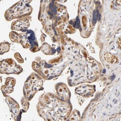 Invitrogen RPS29 Polyclonal Antibody 100 μL; Unconjugated:Antibodies,