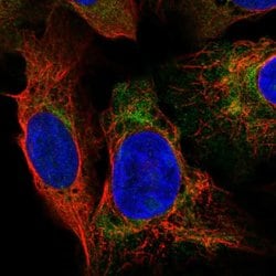 Invitrogen DNAAF2 Polyclonal Antibody 100 &mu;L; Unconjugated:Antibodies,