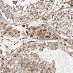 Invitrogen DNAAF2 Polyclonal Antibody 100 &mu;L; Unconjugated:Antibodies,