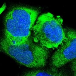Invitrogen RARS Polyclonal Antibody 100 &mu;L; Unconjugated:Antibodies,