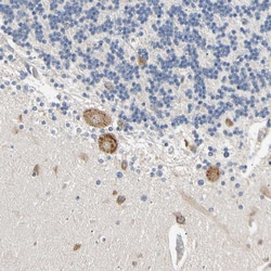 Invitrogen RARS Polyclonal Antibody 100 &mu;L; Unconjugated:Antibodies,