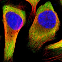 Invitrogen RPL14 Polyclonal Antibody 100 &mu;L; Unconjugated:Antibodies,