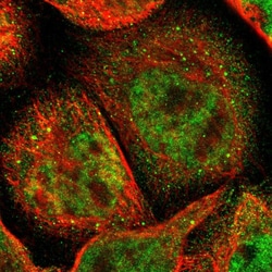 Invitrogen ACSS2 Polyclonal Antibody 100 &mu;L; Unconjugated:Antibodies,