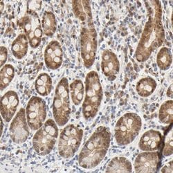 Invitrogen ACSS2 Polyclonal Antibody 100 &mu;L; Unconjugated:Antibodies,