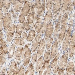 Invitrogen ACSS2 Polyclonal Antibody 100 &mu;L; Unconjugated:Antibodies,