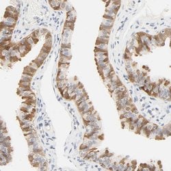 Invitrogen ACSS2 Polyclonal Antibody 100 &mu;L; Unconjugated:Antibodies,