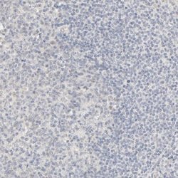 Invitrogen ACSS2 Polyclonal Antibody 100 &mu;L; Unconjugated:Antibodies,