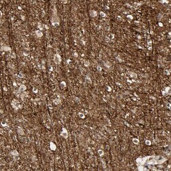 Invitrogen AHNAK2 Polyclonal Antibody 100 &mu;L; Unconjugated:Antibodies,